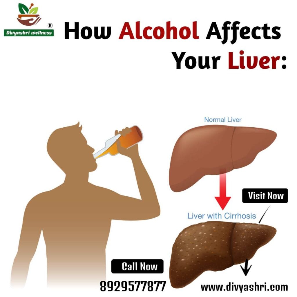 fatty liver