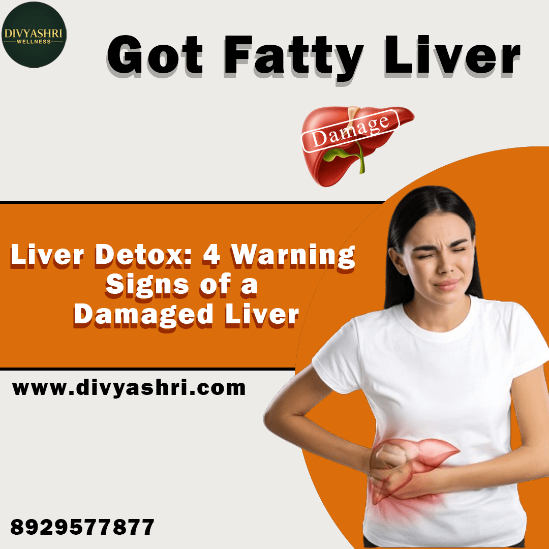 Fatty liver